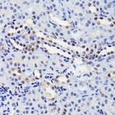 Anti-Phospho-STAT3-S727 antibody produced in rabbit