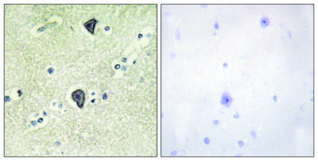 Anti-FGFR3 antibody produced in rabbit affinity isolated antibody