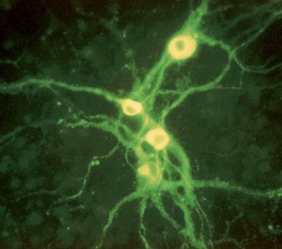 Anti-Tyrosine Hydroxylase Antibody, clone LNC1, Alexa Fluor&#8482; 555 Conjugate clone LNC1, from mouse, ALEXA FLUOR&#8482; 555