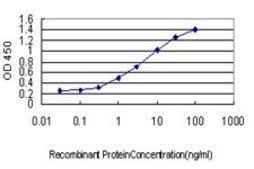 Monoclonal Anti-SLC4A4 antibody produced in mouse clone 1G2, purified immunoglobulin, buffered aqueous solution