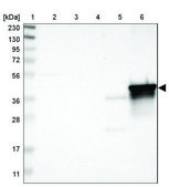 Anti-ASPN antibody produced in rabbit Prestige Antibodies® Powered by Atlas Antibodies, affinity isolated antibody, buffered aqueous glycerol solution