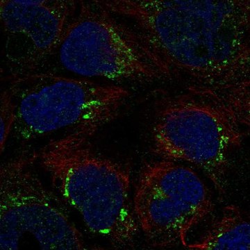 Anti-ATP7B antibody produced in rabbit Prestige Antibodies&#174; Powered by Atlas Antibodies, affinity isolated antibody