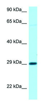 Anti-NIPA1 (C-terminal) antibody produced in rabbit affinity isolated antibody