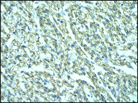 Anti-FGD1 antibody produced in rabbit affinity isolated antibody