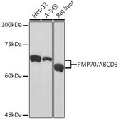 Anti-PMP70/ABCD3 Antibody, clone 3V4K3, Rabbit Monoclonal