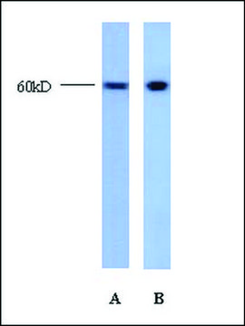 Anti-TRIM22 antibody produced in rabbit affinity isolated antibody