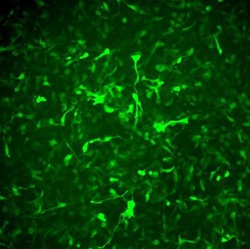 Alzheimer&#8217;s In A Dish&#8482; APPSL-GFP Lentivirus