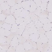 Anti-TRIP13 antibody produced in rabbit Prestige Antibodies® Powered by Atlas Antibodies, affinity isolated antibody, buffered aqueous glycerol solution