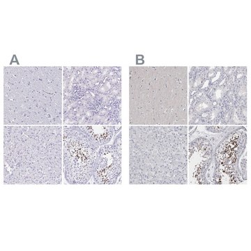 Anti-SPACA1 antibody produced in rabbit Prestige Antibodies&#174; Powered by Atlas Antibodies, affinity isolated antibody, buffered aqueous glycerol solution