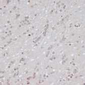 Anti-Phospho-BRCA1-S1423 antibody produced in rabbit