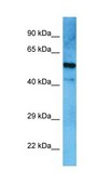 Anti-IKZF3 antibody produced in rabbit affinity isolated antibody