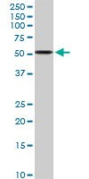 Anti-ALDH3A2 antibody produced in rabbit purified immunoglobulin, buffered aqueous solution