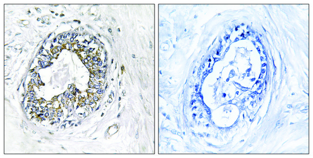 Anti-PAK1 antibody produced in rabbit affinity isolated antibody