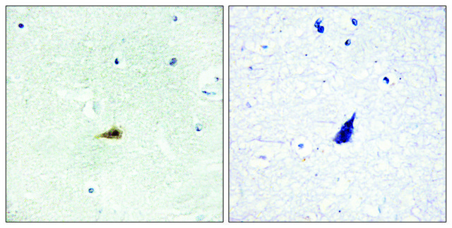 Anti-NCOR2 antibody produced in rabbit affinity isolated antibody