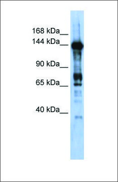 Anti-CASZ1 antibody produced in rabbit affinity isolated antibody