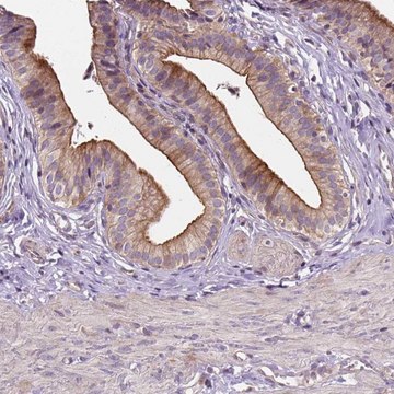 Anti-INPP5E antibody produced in rabbit Prestige Antibodies&#174; Powered by Atlas Antibodies, affinity isolated antibody, buffered aqueous glycerol solution