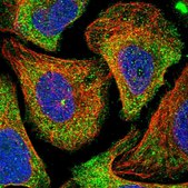 Anti-HGF antibody produced in rabbit Prestige Antibodies® Powered by Atlas Antibodies, affinity isolated antibody, buffered aqueous glycerol solution