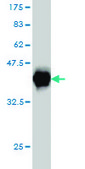 Monoclonal Anti-EWSR1 antibody produced in mouse clone 5C10, purified immunoglobulin, buffered aqueous solution