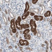 Anti-PDZK1 antibody produced in rabbit Prestige Antibodies® Powered by Atlas Antibodies, affinity isolated antibody, buffered aqueous glycerol solution, Ab1