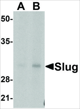 Anti-Slug (ab1) antibody produced in rabbit affinity isolated antibody, buffered aqueous solution