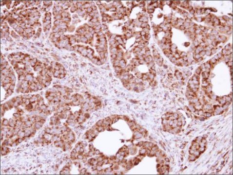 Anti-FIS1 antibody produced in rabbit