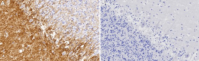 Anti-SLC1A3/EAAT1 Antibody, clone 2C3-K ZooMAb&#174; Rabbit Monoclonal recombinant, expressed in HEK 293 cells