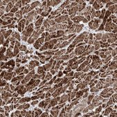 Anti-NDUFB3 antibody produced in rabbit Prestige Antibodies® Powered by Atlas Antibodies, affinity isolated antibody, buffered aqueous glycerol solution