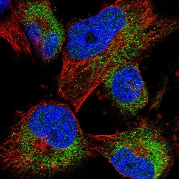 Anti-ACBD7 antibody produced in rabbit Prestige Antibodies&#174; Powered by Atlas Antibodies, affinity isolated antibody, buffered aqueous glycerol solution