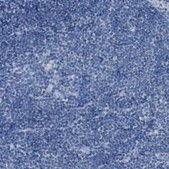 Anti-B4GALNT1 antibody produced in rabbit Prestige Antibodies® Powered by Atlas Antibodies, affinity isolated antibody, buffered aqueous glycerol solution