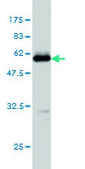 Monoclonal Anti-TPMT antibody produced in mouse clone 1D4, purified immunoglobulin, buffered aqueous solution