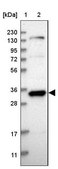 Anti-GTF2E2 antibody produced in rabbit Prestige Antibodies® Powered by Atlas Antibodies, affinity isolated antibody, buffered aqueous glycerol solution