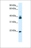 Anti-SYP antibody produced in rabbit affinity isolated antibody