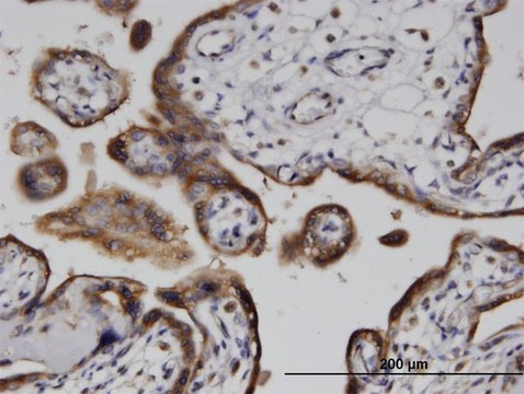 Monoclonal Anti-ADPRH antibody produced in mouse clone 1F11, purified immunoglobulin, buffered aqueous solution