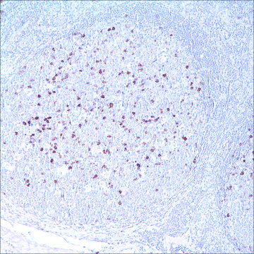 CD57 (NK-1) Mouse Monoclonal Antibody