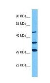 Anti-GLIS3 antibody produced in rabbit affinity isolated antibody