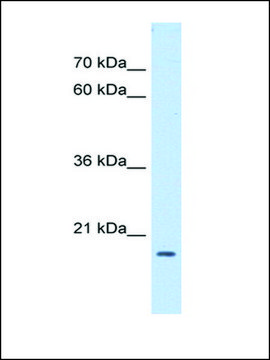 Anti-ASF1B antibody produced in rabbit affinity isolated antibody