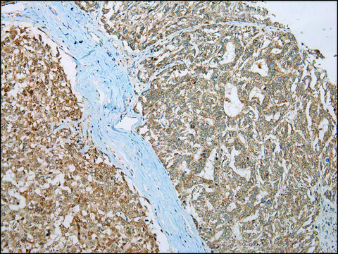 Anti-CCBL1 affinity isolated antibody