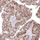 Anti-CDX2 antibody produced in mouse Prestige Antibodies® Powered by Atlas Antibodies, clone CL12974, purified by using Protein A, buffered aqueous glycerol solution