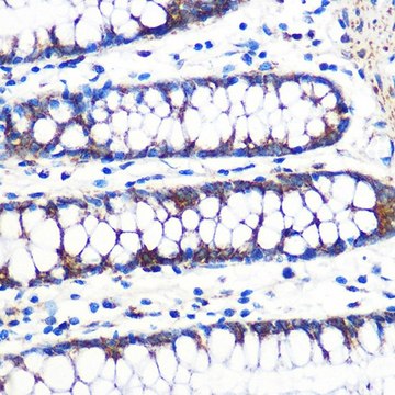 Anti-TFAM antibody produced in rabbit