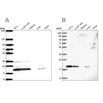 Anti-NDUFAF2 antibody produced in rabbit Prestige Antibodies&#174; Powered by Atlas Antibodies, affinity isolated antibody, buffered aqueous glycerol solution