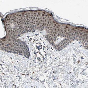 Anti-RPS6KB2 antibody produced in rabbit Prestige Antibodies&#174; Powered by Atlas Antibodies, affinity isolated antibody, buffered aqueous glycerol solution