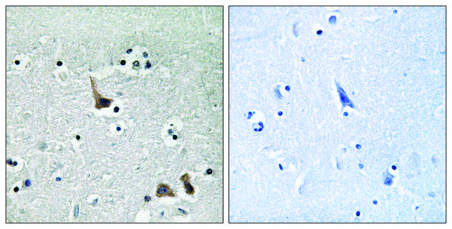 Anti-ATP6V1H antibody produced in rabbit affinity isolated antibody