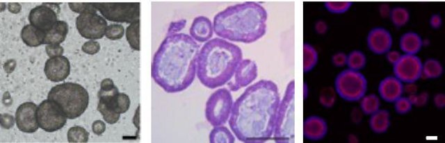 3dGRO&#174; Human CRC Organoids (ISO72)