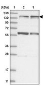 Anti-KIF4A antibody produced in rabbit Prestige Antibodies® Powered by Atlas Antibodies, affinity isolated antibody, buffered aqueous glycerol solution