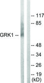 Anti-GRK1 antibody produced in rabbit affinity isolated antibody