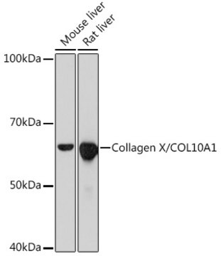 Anti-Collagen X/COL10A1 Antibody, clone 0F5Q9, Rabbit Monoclonal