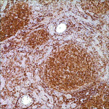 BCL2 (E17) Rabbit Monoclonal Primary Antibody