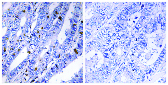 Anti-PKA-R2 &#946; antibody produced in rabbit affinity isolated antibody