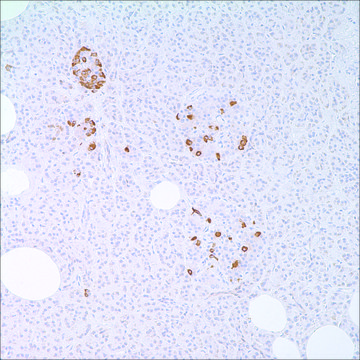 Somatostatin Rabbit Polyclonal Antibody