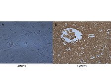 OxyIHC Oxidative Stress Detection Kit The OxyIHC Oxidative Stress Detection Kit contains the chemical &amp; immunological reagents necessary to detect protein oxidation in various tissues from a variety of organs &amp; animal species.